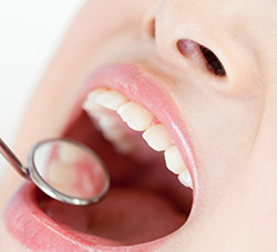 歯科治療の画像